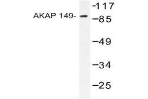 Western blot analysis of AKAP149 Antibody in extracts from HUVEC cells. (AKAP1 anticorps)