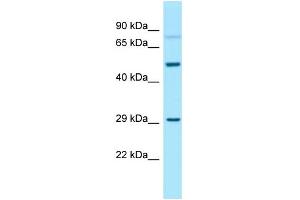 WB Suggested Anti-GNA13 Antibody Titration: 1. (GNA13 anticorps  (N-Term))