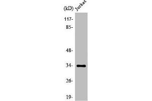 Western Blot analysis of Jurkat cells using Olfactory receptor 51D1 Polyclonal Antibody (OR51D1 anticorps  (Internal Region))