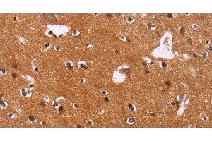 Immunohistochemistry of paraffin-embedded Human brain using CBX3 Polyclonal Antibody at dilution of 1:40 (CBX3 anticorps)