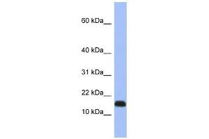 RPL37A antibody used at 1 ug/ml to detect target protein. (RPL37A anticorps  (Middle Region))