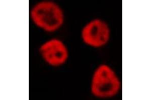ABIN6268848 staining HeLa cells by IF/ICC.