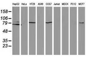 Image no. 2 for anti-Catenin (Cadherin-Associated Protein), beta 1, 88kDa (CTNNB1) antibody (ABIN1496897) (CTNNB1 anticorps)