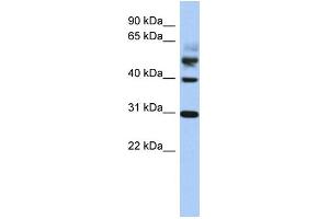 WB Suggested Anti-TTL Antibody Titration: 0. (TTL anticorps  (Middle Region))