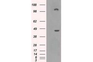 Image no. 7 for anti-Lysyl Oxidase (LOX) (AA 22-168) antibody (ABIN1491218)
