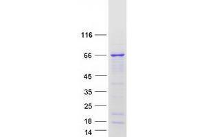 Validation with Western Blot