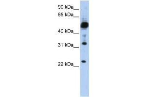 Western Blotting (WB) image for anti-Transmembrane Protein 38B (TMEM38B) antibody (ABIN2459106) (TMEM38B anticorps)