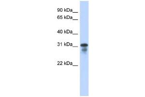 WB Suggested Anti-MED6 Antibody Titration:  0. (MED6 anticorps  (Middle Region))