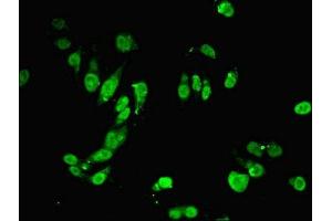 anti-MutS Homolog 6 (E. Coli) (MSH6) (AA 1-400) antibody