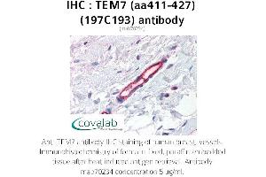 Image no. 1 for anti-Plexin Domain Containing 1 (PLXDC1) (AA 411-427) antibody (ABIN5693726) (PLXDC1 anticorps  (AA 411-427))