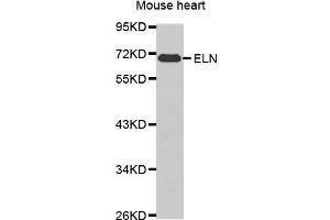 Western blot analysis of extracts of various cell lines, using ELN antibody. (Elastin anticorps  (AA 27-200))