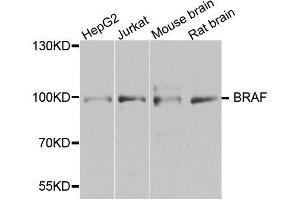 Western blot analysis of extracts of various cell lines, using BRAF antibody. (BRAF anticorps  (AA 280-460))