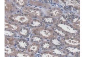 Detection of SNAI1 in Human Kidney Tissue using Polyclonal Antibody to Snail Homolog 1 (SNAI1)