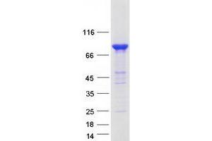 Validation with Western Blot