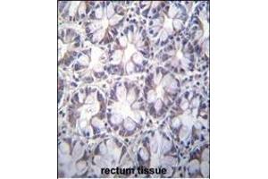 anti-Tubulin Folding Cofactor A (TBCA) (AA 30-58) antibody