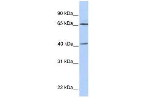 GLA antibody used at 1 ug/ml to detect target protein. (GLA anticorps  (N-Term))