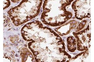 ABIN6268779 at 1/100 staining human kidney tissue sections by IHC-P. (Aquaporin 1 anticorps  (Internal Region))