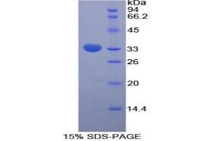 SDS-PAGE analysis of Rat FUCa1 Protein. (FUCA1 Protéine)