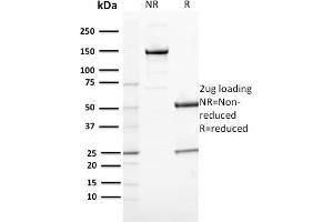 SDS-PAGE Analysis Purified CD163 Mouse Monoclonal Antibody (M130/2164). (CD163 anticorps  (AA 43-196))