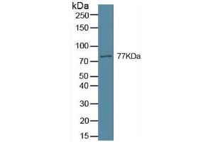 Rabbit Detection antibody from the kit in WB with Positive Control: Sample Hela cell lysate.