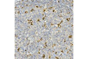 Immunohistochemistry of paraffin-embedded mouse testis using CDK1 Rabbit mAb (ABIN7266576) at dilution of 1:100 (40x lens).