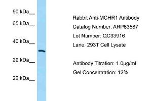 Western Blotting (WB) image for anti-Melanin-Concentrating Hormone Receptor 1 (MCHR1) (N-Term) antibody (ABIN971125) (MCHR1 anticorps  (N-Term))