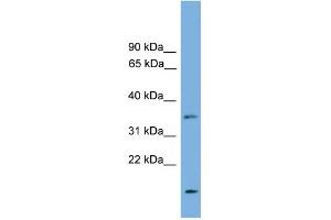 WB Suggested Anti-LIX1L Antibody Titration: 0. (LIX1L anticorps  (N-Term))