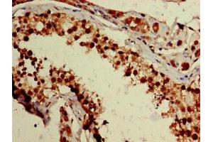 Immunohistochemistry of paraffin-embedded human testis tissue using ABIN7176240 at dilution of 1:100 (ZNF331 anticorps  (AA 179-442))