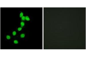 Immunofluorescence analysis of HepG2 cells, using DYR1A Antibody. (DYRK1A anticorps  (AA 21-70))