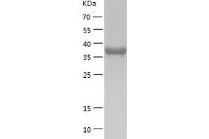 Western Blotting (WB) image for CAMP Responsive Element Binding Protein 3-Like 2 (CREB3L2) (AA 1-378) protein (His tag) (ABIN7122114)