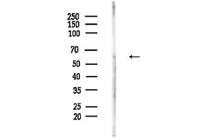 Western blot analysis of lysates from Hela cells(LPS,4h treatment), using C Antibody at 1/1000 dilution.