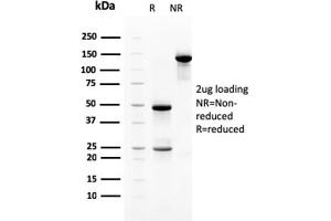 SDS-PAGE Analysis Purified Heregulin-1 Mouse Monoclonal Antibody (NRG1/2710). (Neuregulin 1 anticorps  (AA 21-242))