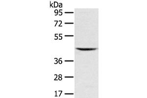 Western Blot analysis of Mouse kidney tissue using VSIG8 Polyclonal Antibody at dilution of 1/400 (VSIG8 anticorps)