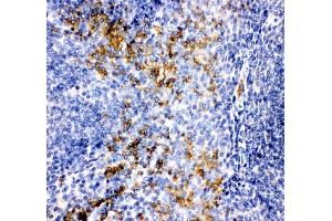 IHC analysis of MCP1/CCL2 using anti-MCP1/CCL2 antibody (ABIN3042598). (CCL2 anticorps  (AA 24-99))