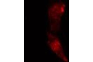 ABIN6274121 staining Hela cells by IF/ICC. (TACC1 anticorps  (N-Term))
