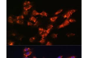 Immunofluorescence analysis of C6 cells using DPP4 Polyclonal Antibody at dilution of 1:100. (DPP4 anticorps)