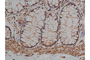 ABIN6268881 at 1/200 staining human colon tissue sections by IHC-P. (Desmin anticorps)