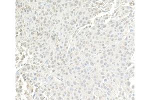 Immunohistochemistry (IHC) image for anti-SWI/SNF Related, Matrix Associated, Actin Dependent Regulator of Chromatin, Subfamily A, Member 4 (SMARCA4) (AA 75-125) antibody (ABIN7454677)