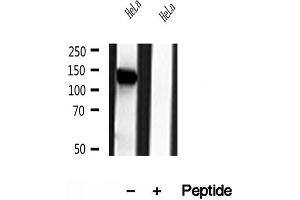 Western blot analysis of extracts of HeLa cells, using NBR1 antibody. (NBR1 anticorps)