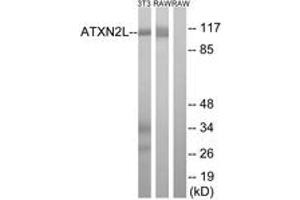 Western blot analysis of extracts from NIH-3T3/RAW264. (Ataxin 2-Like anticorps  (AA 571-620))