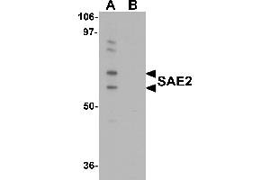 Western Blotting (WB) image for anti-SUMO1 Activating Enzyme Subunit 2 (UBA2) (C-Term) antibody (ABIN1030636) (UBA2 anticorps  (C-Term))