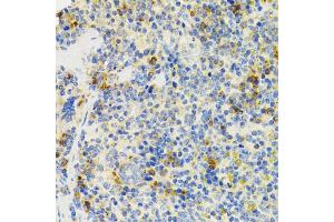 Immunohistochemistry of paraffin-embedded mouse spleen using SH2B1 Antibody. (SH2B1 anticorps)