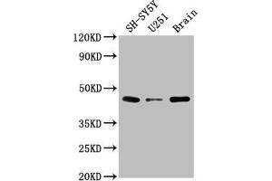 Western Blot Positive WB detected in: SH-SY5Y whole cell lysate, U251 whole cell lysate, Rat brain tissue All lanes: LRTM2 antibody at 1:2000 Secondary Goat polyclonal to rabbit IgG at 1/50000 dilution Predicted band size: 42 kDa Observed band size: 42 kDa (LRTM2 anticorps  (AA 36-310))