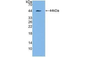 Detection of Recombinant KRT7, Human using Polyclonal Antibody to Cytokeratin 7 (CK7) (Cytokeratin 7 anticorps  (AA 91-394))
