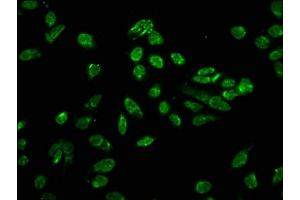 Immunofluorescence staining of Hela cells with ABIN7139630 at 1:10, counter-stained with DAPI. (HIST1H3A anticorps  (H3T80ph))