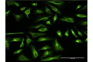Immunofluorescence of monoclonal antibody to PRC1 on HeLa cell.
