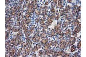 Image no. 12 for anti-Destrin (Actin Depolymerizing Factor) (DSTN) antibody (ABIN1497907)