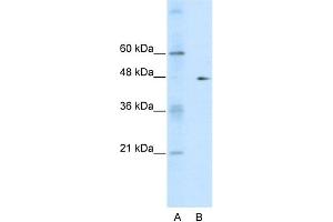 WB Suggested Anti-GDI2  Antibody Titration: 0. (GDI2 anticorps  (C-Term))