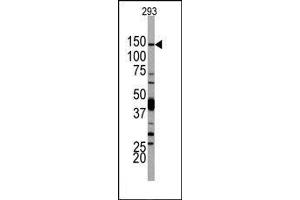 Image no. 1 for anti-Phosphoinositide-3-Kinase, Catalytic, delta Polypeptide (PIK3CD) (N-Term) antibody (ABIN360449) (PIK3CD anticorps  (N-Term))