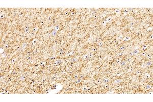 Detection of GSTa2 in Porcine Cerebrum Tissue using Polyclonal Antibody to Glutathione S Transferase Alpha 2 (GSTa2)